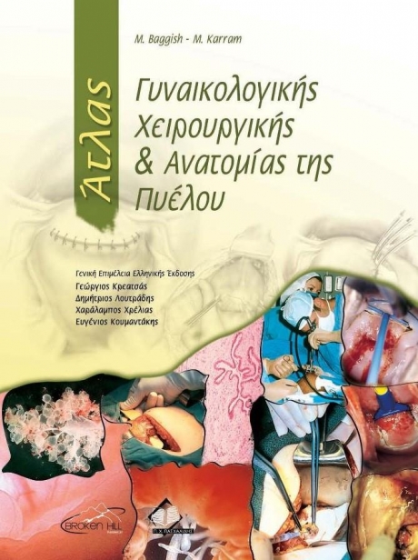 BAGGISH ΑΤΛΑΣ ΓΥΝΑΙΚΟΛΟΓΙΚΗΣ ΧΕΙΡ/ΚΗΣ & ΑΝΑΤΟΜΙΑΣ ΠΥΕΛΟΥ