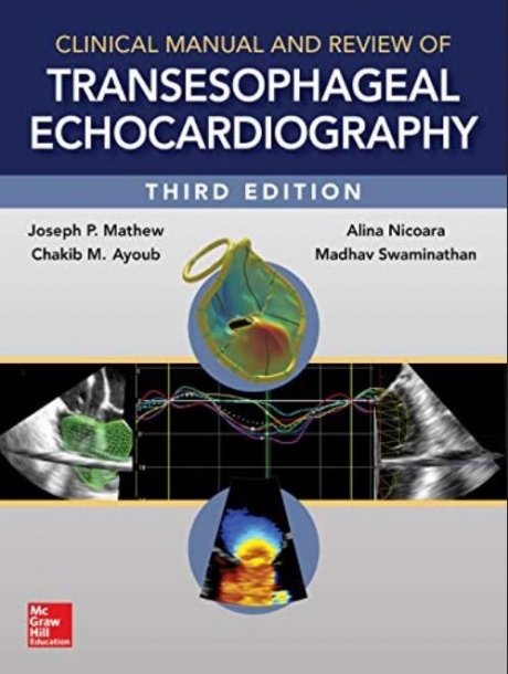Clinical Manual and Review of Transesophageal Echocardiography, 3rd Edition