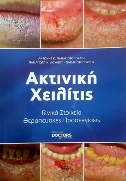Ακτινική Χειλίτις, Γενικά Στοιχεία - Θεραπευτικές Προσεγγίσεις, 1η Έκδοση