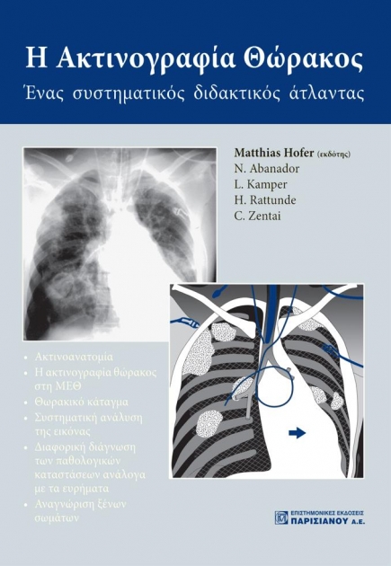 Η Ακτινογραφία Θώρακος: Ένας Συστηματικός Διδακτικός Άτλαντας, 1η Έκδοση