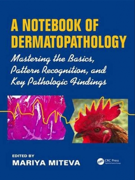 A Notebook of Dermatopathology: Mastering the Basics, Pattern Recognition, and Key Pathologic Findings, 1st Edition