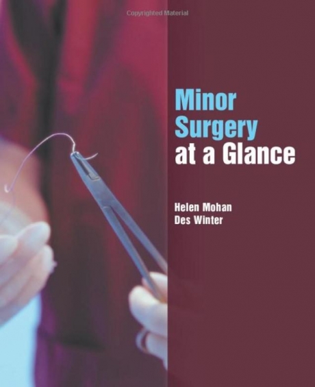 Minor Surgery at a Glance