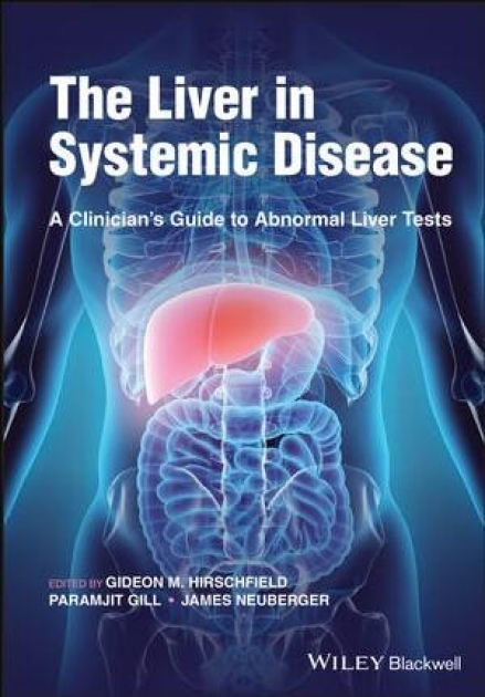 The Liver in Systemic Disease: A Clinician`s Guide to Abnormal Liver Tests