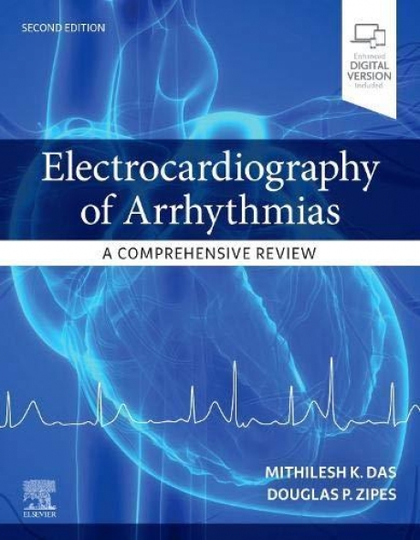 Electrocardiography of Arrhythmias: A Comprehensive Review: A Companion to Cardiac Electrophysiology, 2nd Edition