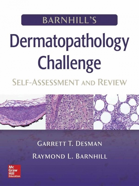 Barnhill`s Dermatopathology Challenge: Self-Assessment & Review