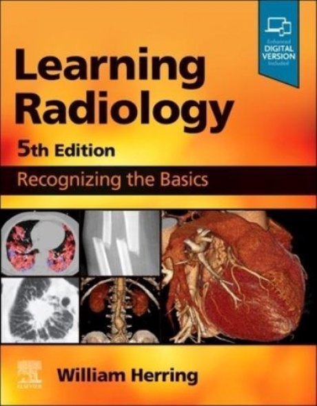 Learning Radiology: Recognizing the Basics, 5th Edition