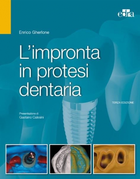 L`impronta in protesi dentaria, 4th Εdizione