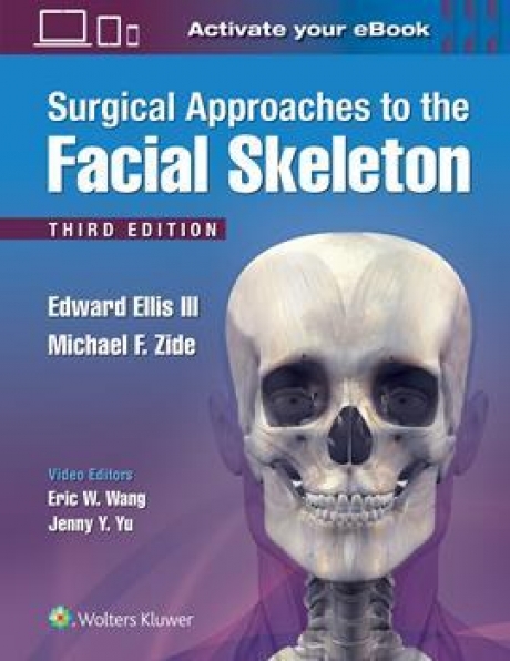 Surgical Approaches to the Facial Skeleton, 3rd Edition
