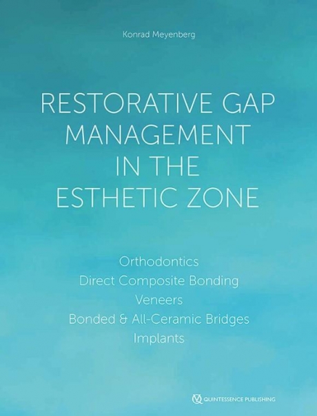 Restorative Gap Management in the Esthetic Zone, 1st Edition