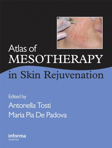 Atlas of Mesotherapy in Skin Rejuvenation, 1st Edition