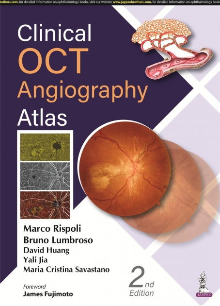 Clinical OCT Angiography Atlas, 2nd Edition