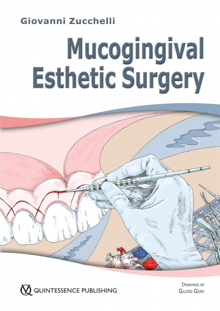 Mucogingival Esthetic Surgery, 1st Edition
