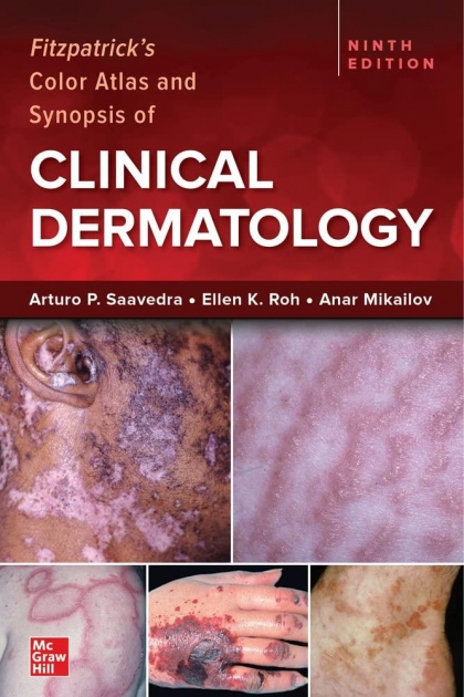 Fitzpatrick`s Color Atlas and Synopsis of Clinical Dermatology, 9th Edition, IE