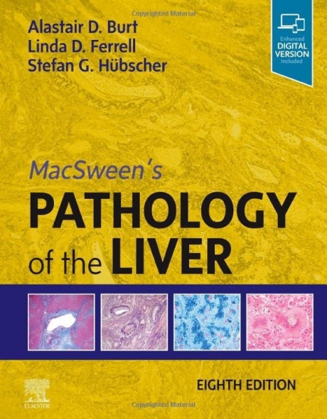 MacSween`s Pathology of the Liver, 8th Edition