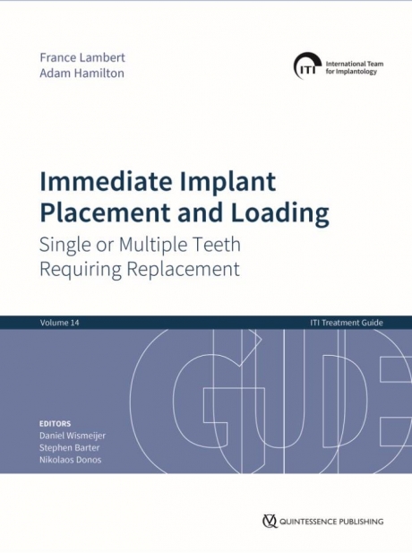 Immediate Implant Placement and Loading – Single or Multiple Teeth Requiring Replacement, 1st Edition