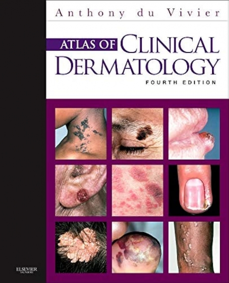 Du vivier Atlas of Clinical Dermatology 4/e