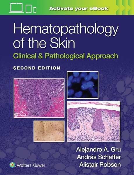 Hematopathology of the Skin Clinical & Pathological Approach, 2nd Edition