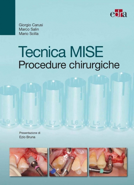 Tecnica MISE. Procedure chirurgiche (Italian Edition)
