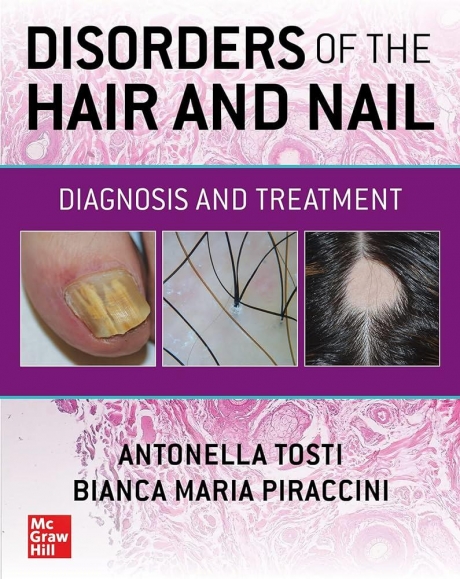 Disorders of the Hair and Nail Diagnosis and Treatment