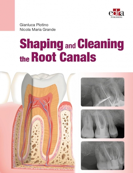 Shaping and Cleaning the Root Canals, 1st Edition