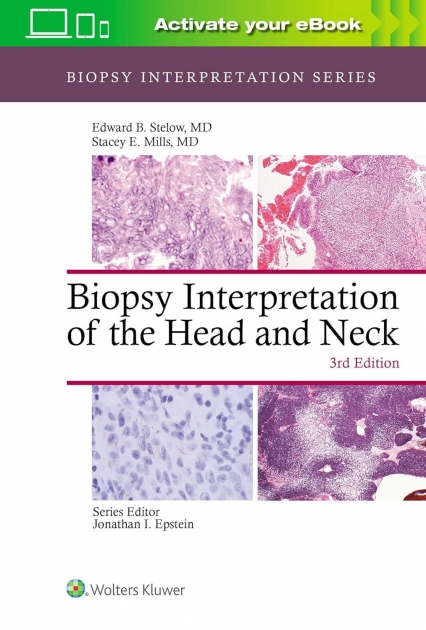 Biopsy Interpretation of the Head and Neck, 3rd Edition
