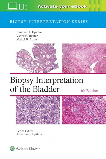 Biopsy Interpretation of the Bladder: Print + eBook with Multimedia, 4th Edition