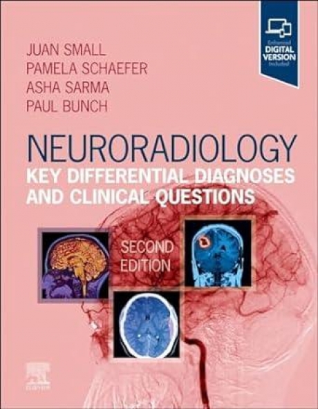 Neuroradiology Key Differential Diagnoses and Clinical Questions, 2nd Edition