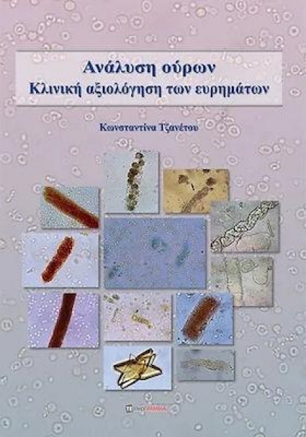 Ανάλυση ούρων κλινική αξιολόγηση των ευρημάτων