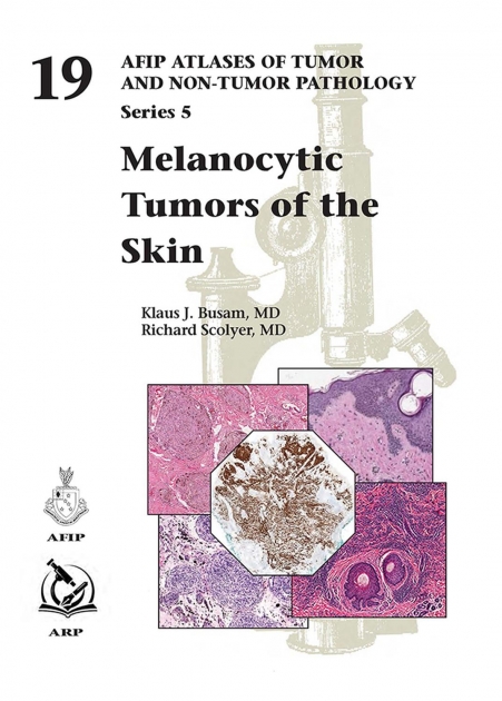AFIP Atlases of Tumor and Non-tumor Pathology, Series 5, Fascicle 19, Melanocytic Tumors of the Skin