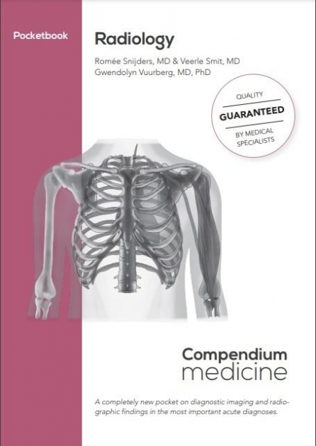 Pocket Radiology