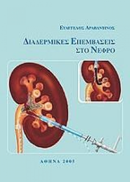 Διαδερμικές Επεμβάσεις στο Νεφρό