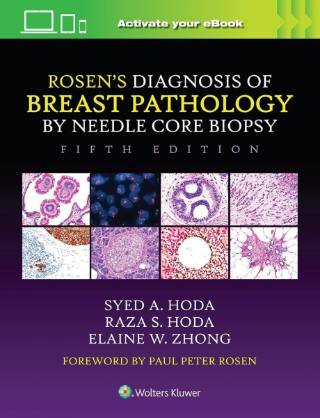 Rosen`s Diagnosis of Breast Pathology by Needle Core Biopsy, 5th Edition