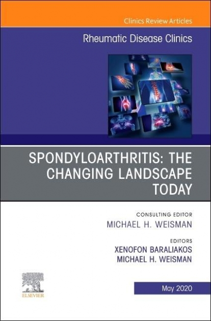 Spondyloarthritis: The Changing Landscape Today, An Issue of Rheumatic Disease Clinics of North America, Volume 46-2