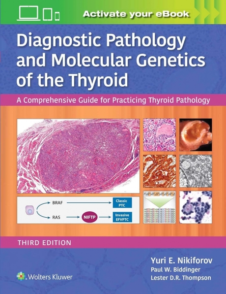 Diagnostic Pathology and Molecular Genetics of the Thyroid: A Comprehensive Guide for Practicing Thyroid Pathology, 3rd Edition