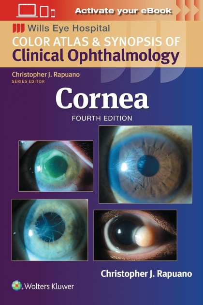 Cornea: Print + eBook with Multimedia, 4th Edition