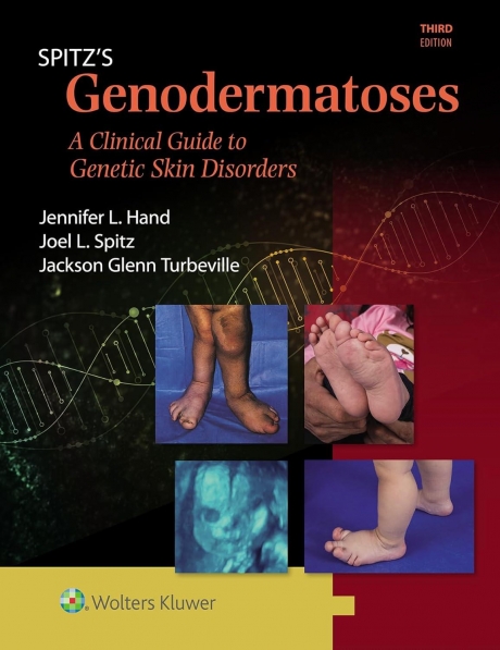 Spitz`s Genodermatoses: A Full Color Clinical Guide to Genetic Skin Disorders, 3rd Edition