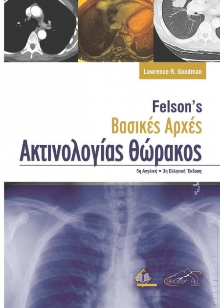 Felson`s Βασικές Αρχές Ακτινολογίας Θώρακος, 3η Έκδοση