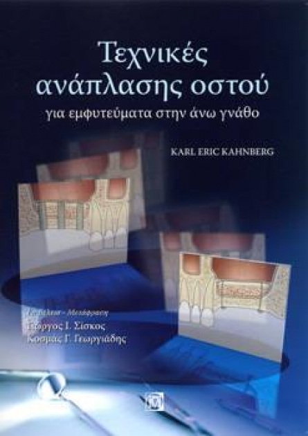 Τεχνικές Ανάπλασης Οστού για Εμφυτεύματα στην Άνω Γνάθο