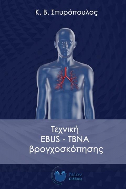 Τεχνική EBUS-TBNA Βρογχοσκόπησης