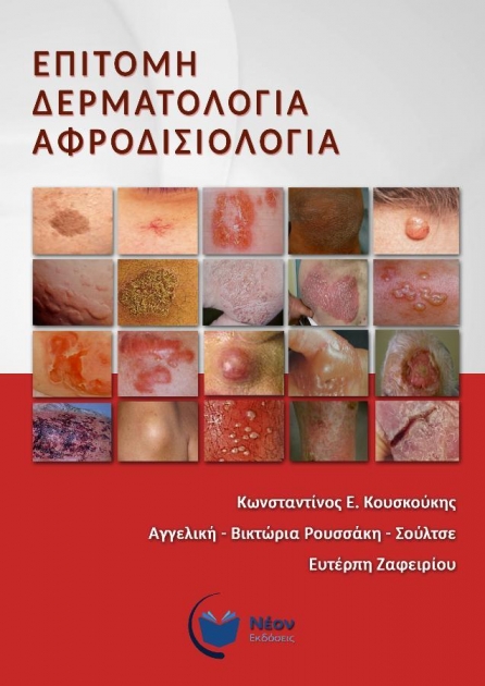 Επίτομη Δερματολογία Αφροδισιολογία