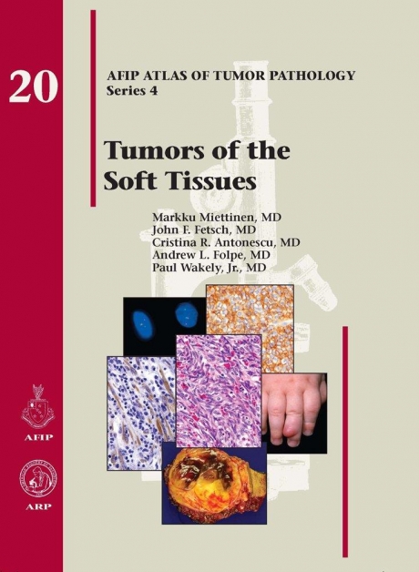 Tumors of the Soft Tissue