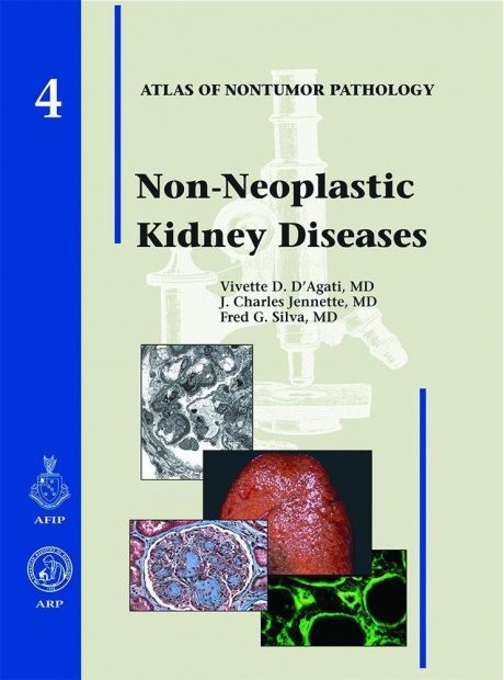 Non-neoplastic Kidney Diseases