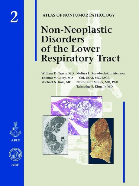 Non-Neoplastic Disorders of the Lower Respiratory Tract
