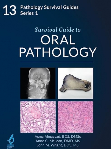 Survival Guide to Oral Pathology