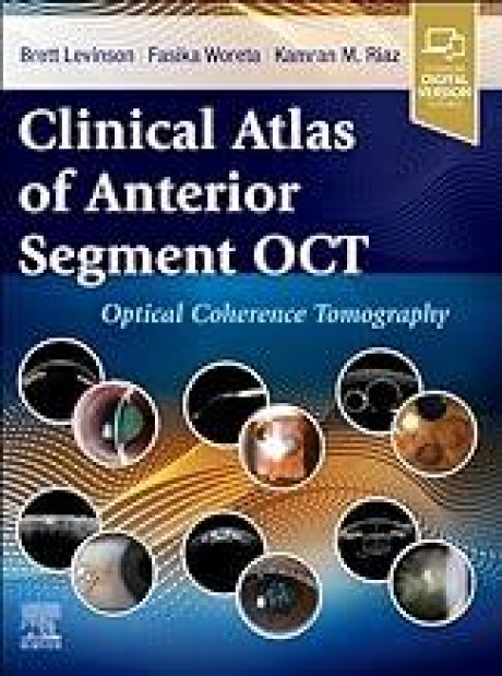 Clinical Atlas of Anterior Segment OCT: Optical Coherence Tomography