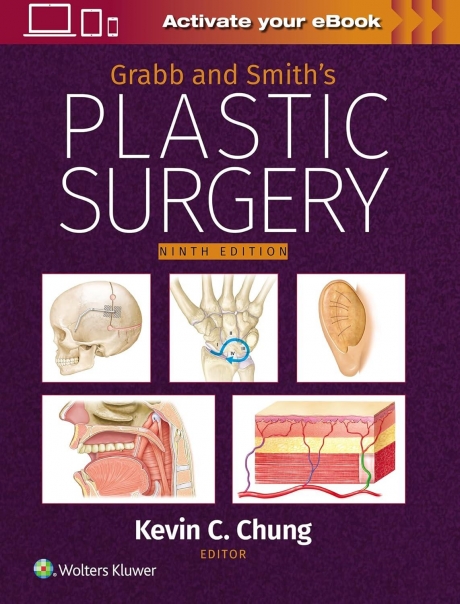 Grabb and Smith`s Plastic Surgery, 9th Edition