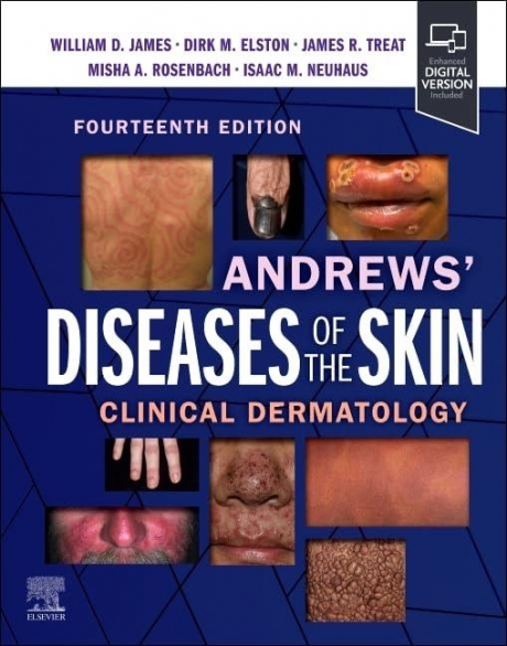 Andrews` Diseases of the Skin: Clinical Dermatology, 14th Edition