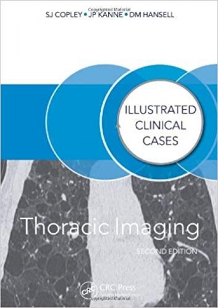 THORACIC IMAGING Illustrated Clinical Cases 2ND Edition