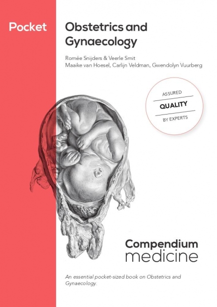 Pocket Obstetrics and Gynaecology
