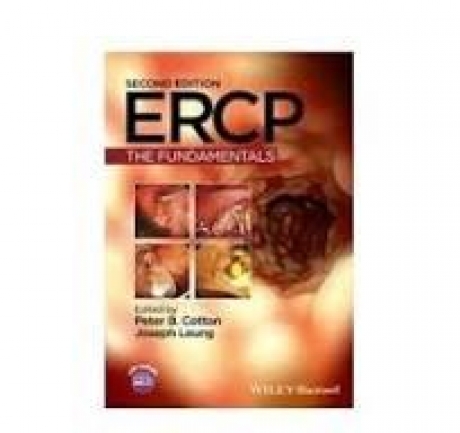 Cotton ERCP: The Fundamentals